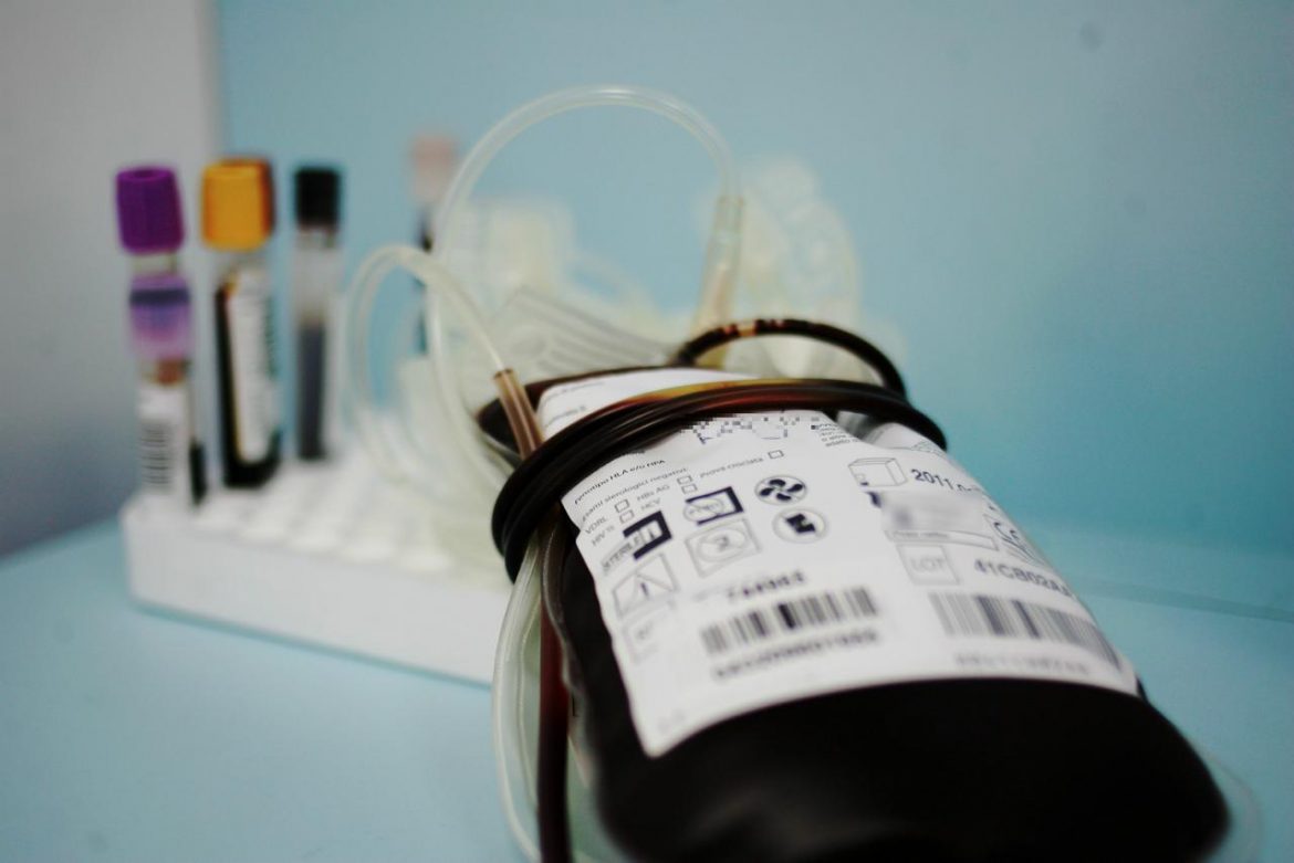 Sangue_ftg_1216_pixelate_3-5-1632655643-057.jpg