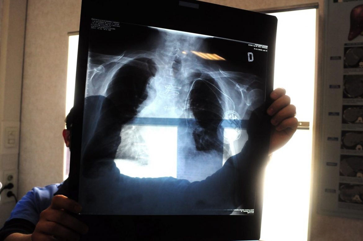 radiografia_fg_3-1-3092912372_3-4-3877270534.jpg