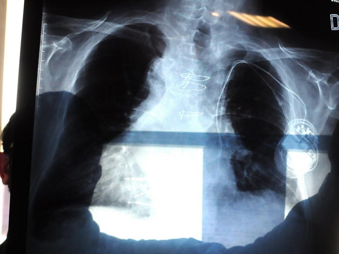 radiografia_fg-kJFE-1280×960@Web.jpg