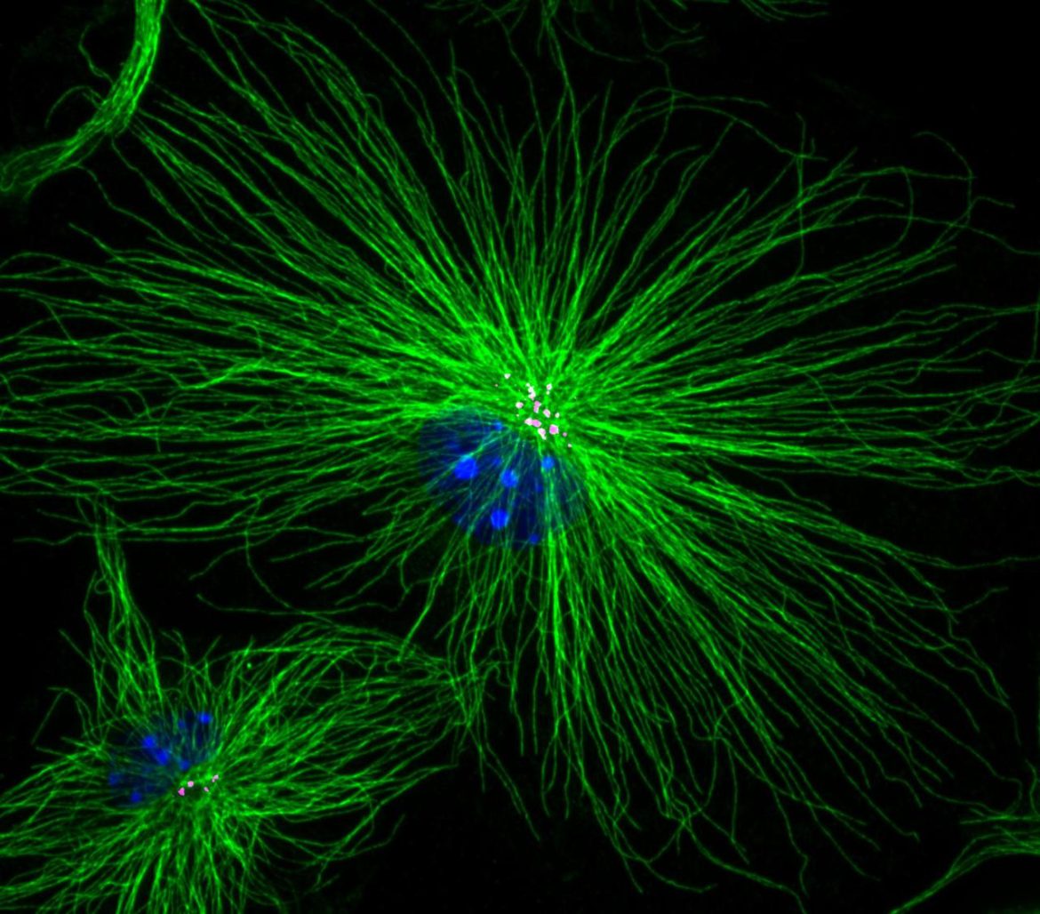 Microglia_19979.jpg