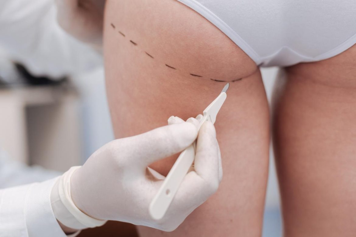 chirurgia_plastica_glutei_123RF.jpg