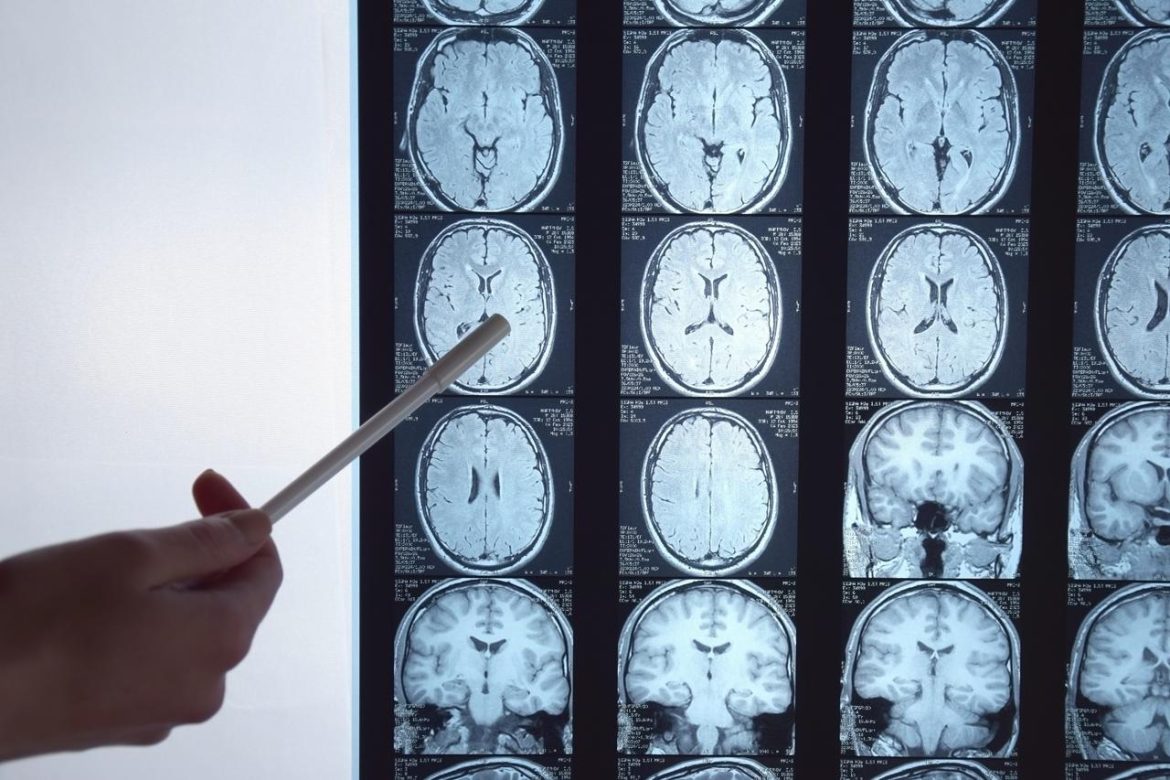 radiografia_cervello_123RF.jpg
