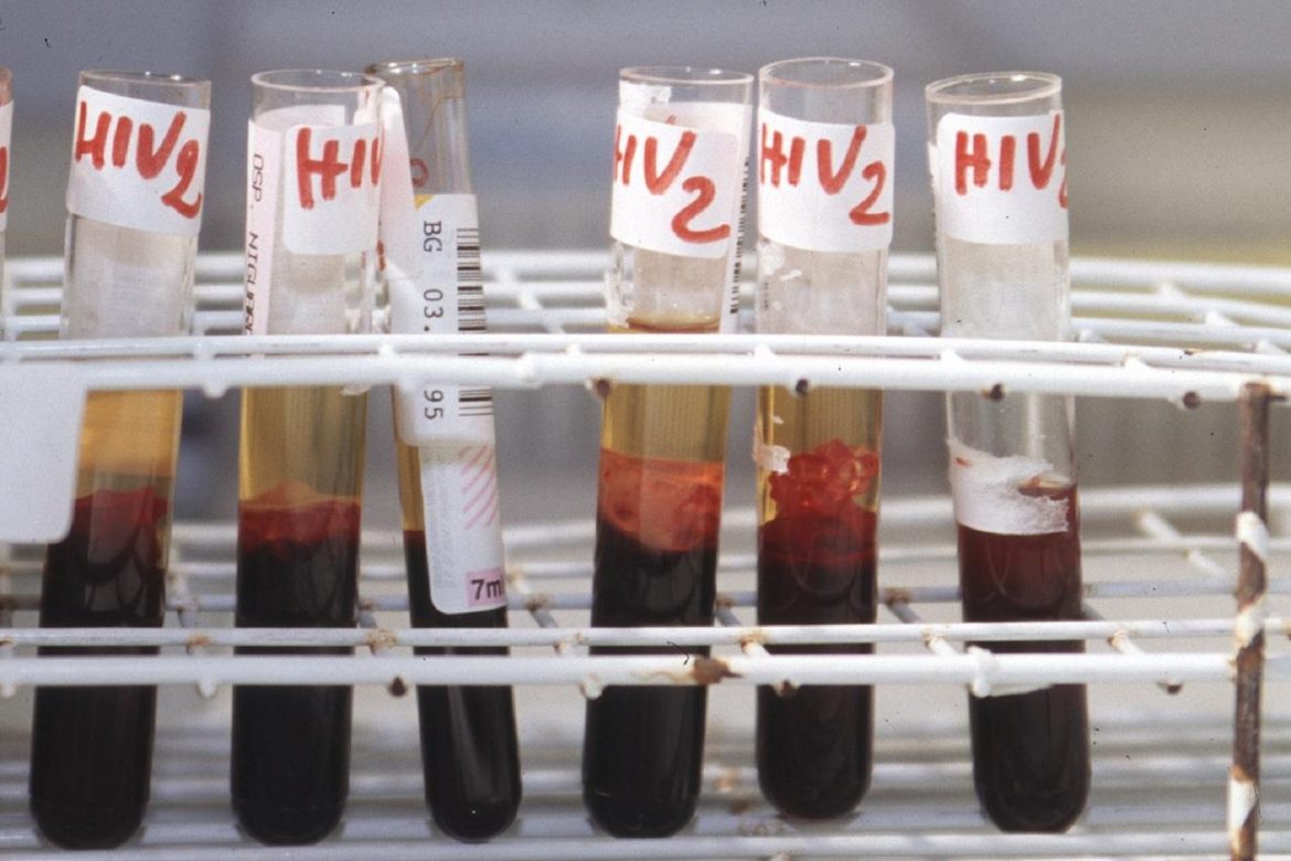 hiv_sangue_provette_fg_3-4-4002775367.jpg
