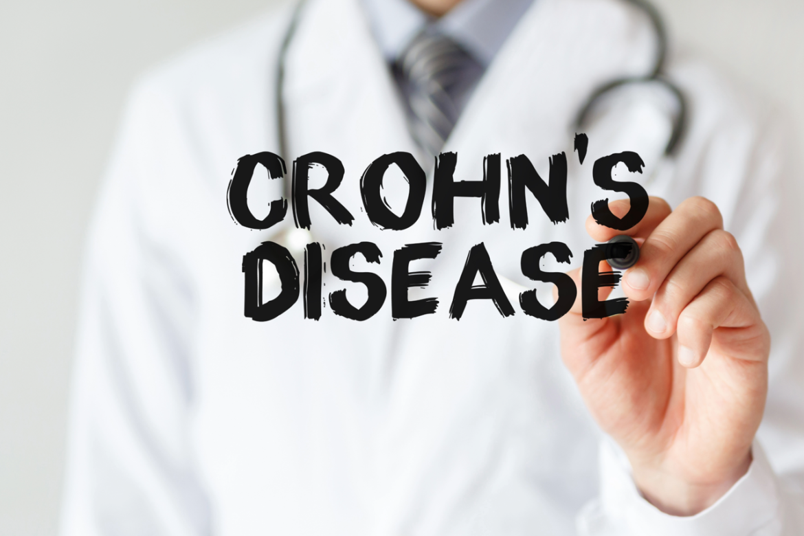 crohn_adobe_free_20240208154406.png