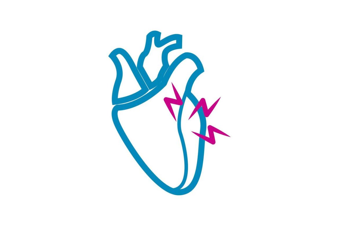 cuore_dolore_infarto_123rf_free.jpg