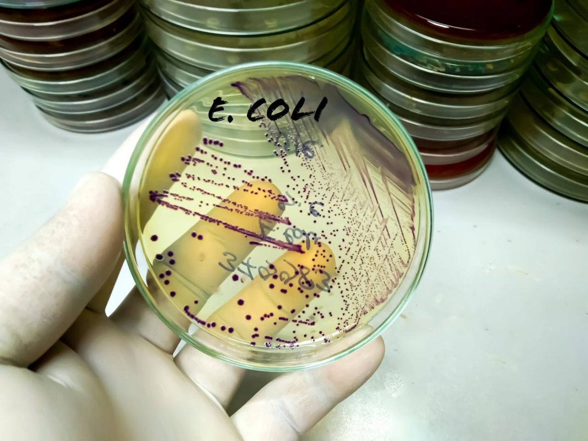 escheria-coli-free.jpeg