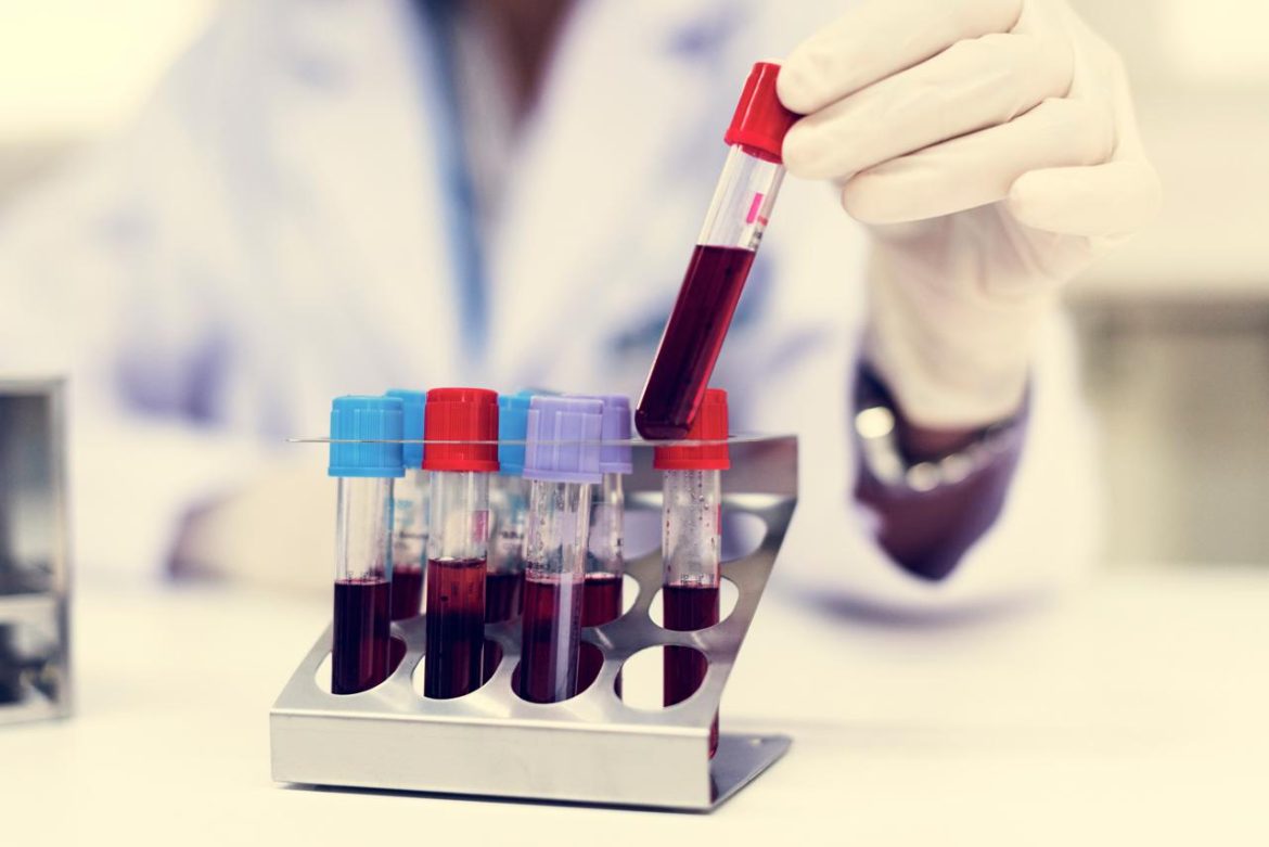 esame_sangue_provette_123RF.jpg