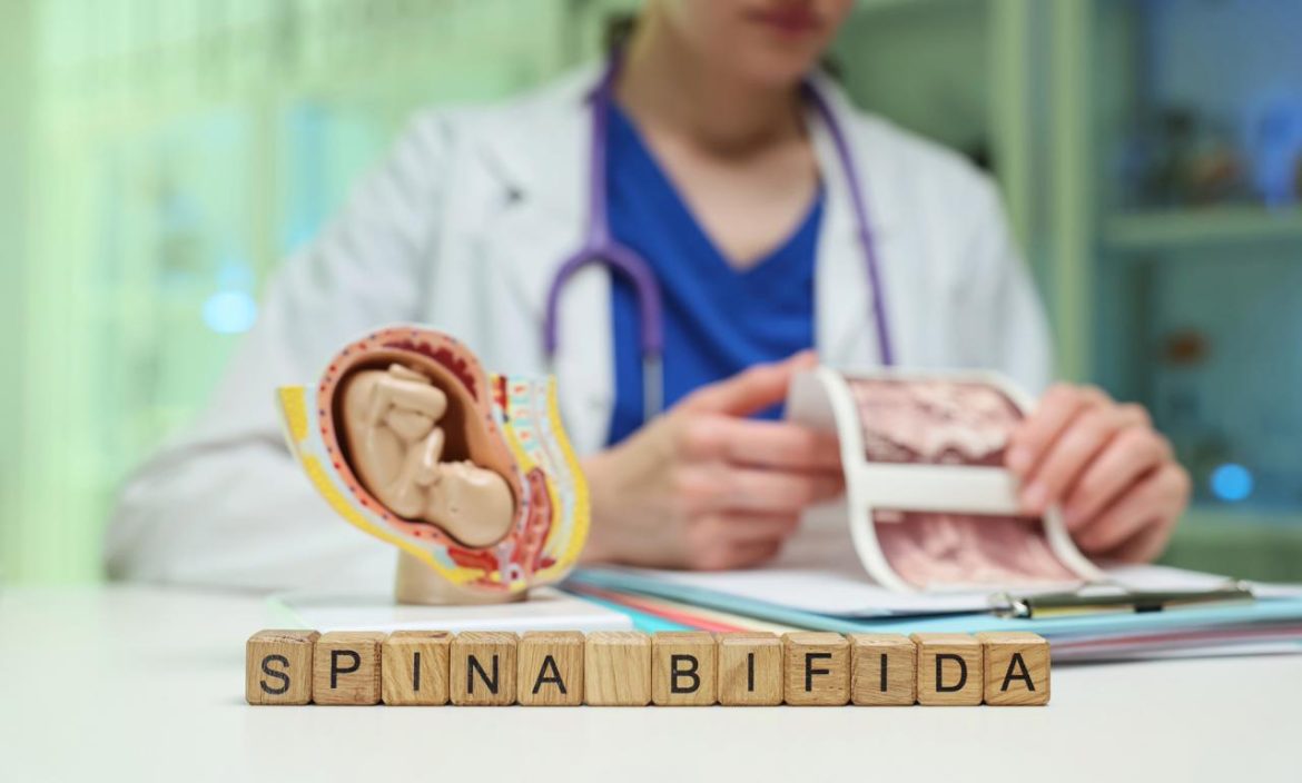 spinabifida_free.jpeg